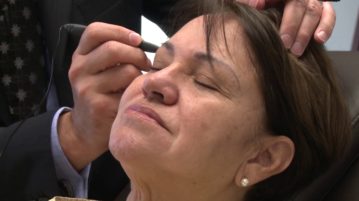 ThermiRase: Wrinkle Eraser