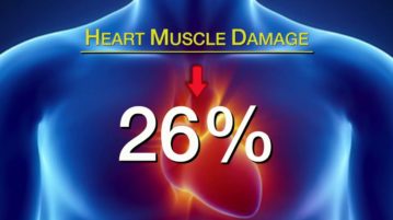 Supersaturated O2 Therapy for Heart Attacks