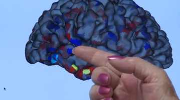 EGI Keeps Alina On Her Toes: Epilepsy Breakthrough