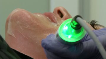 TempSure Skin Tightening