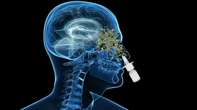 tobacco dust retinal detachment A Sign of Trouble: How to locate and identify a telltale finding that could  prevent a near-future retinal detachment - Document
