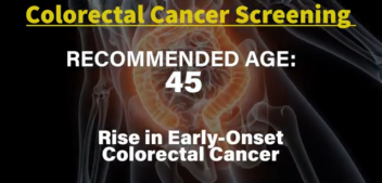 Risk Factors for Early-Onset Colorectal Cancer