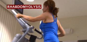 Muscle Pain That Could Kill: Rhabdomyolysis