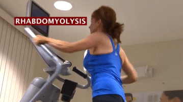 Muscle Pain That Could Kill: Rhabdomyolysis