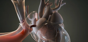 Breathing Pain Free After Heart Surgery!