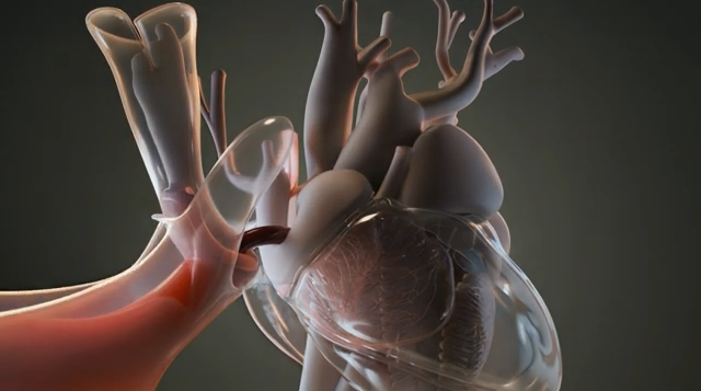 Breathing Pain Free After Heart Surgery!