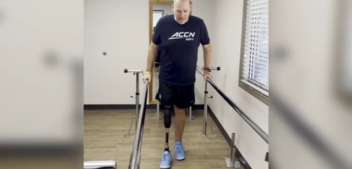 Smarter Step: New Tech Helping Amputees