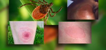 Protecting Fido: New Summer Tick Threats