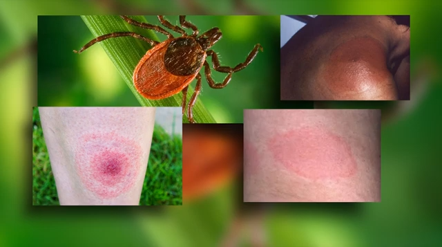 Protecting Fido: New Summer Tick Threats