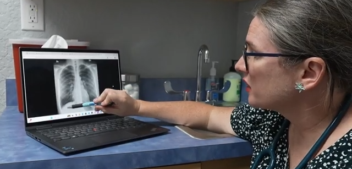 Lung Cancer Stigma Can Kill