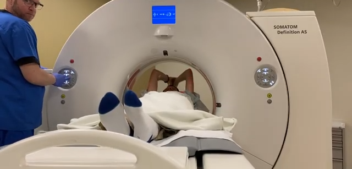 Scan For Life: Spotting Ascending Aortic Aneurysms
